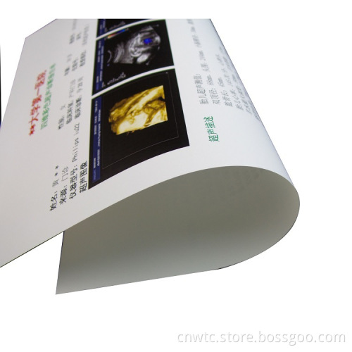 Double-Sided White Medical Laser Film for Ultrasound Imaging and Inkjet Printing